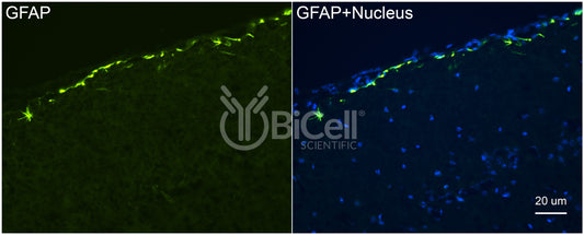 GFAP Antibody - Western Blot Validated