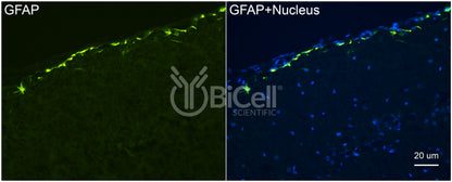 GFAP Antibody