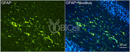 GFAP Antibody - FFPE Validated