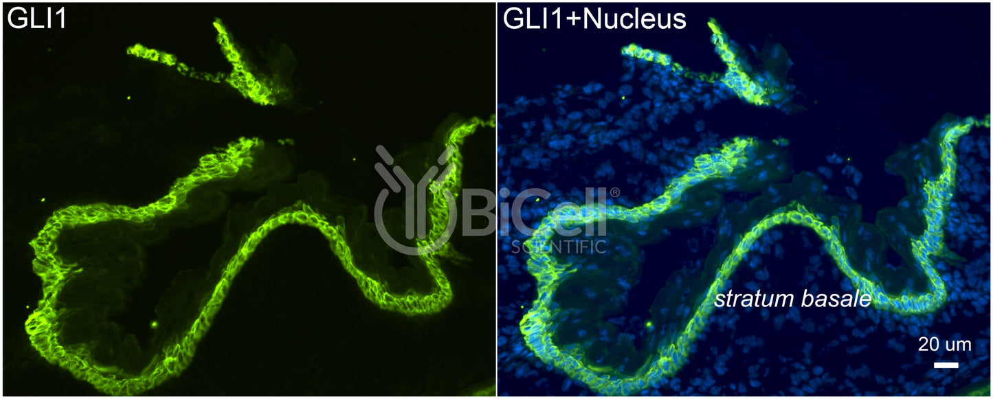 GLI1 Antibody - FFPE Validated