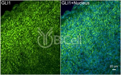 GLI1 Antibody - Western Blot Validated