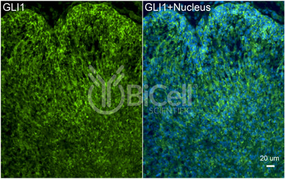 GLI1 Antibody - Western Blot Validated