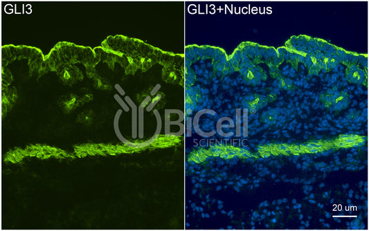 GLI3 Antibody - FFPE Validated