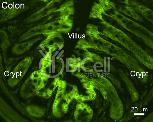 GLUT1 (SLC2A1) Antibody
