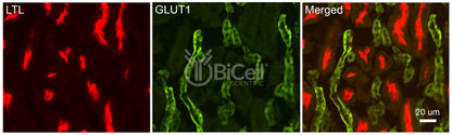 GLUT1 (SLC2A1) Antibody - FFPE Validated