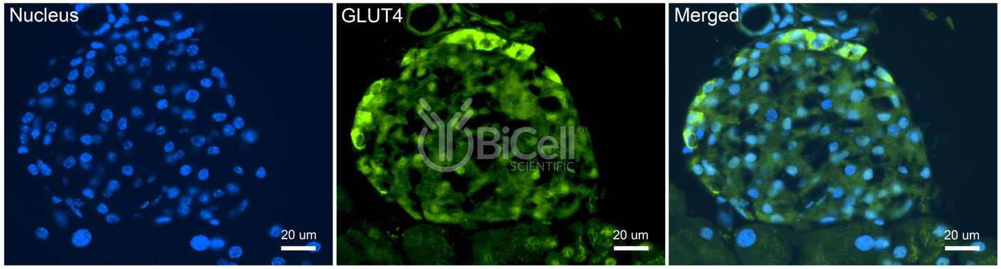 GLUT4 (SLC2A4) Antibody - Western Blot Validated