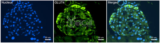 GLUT4 (SLC2A4) Antibody - Western Blot Validated