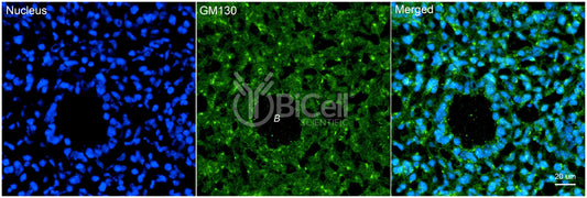 GOLGA2 (GM130) Antibody
