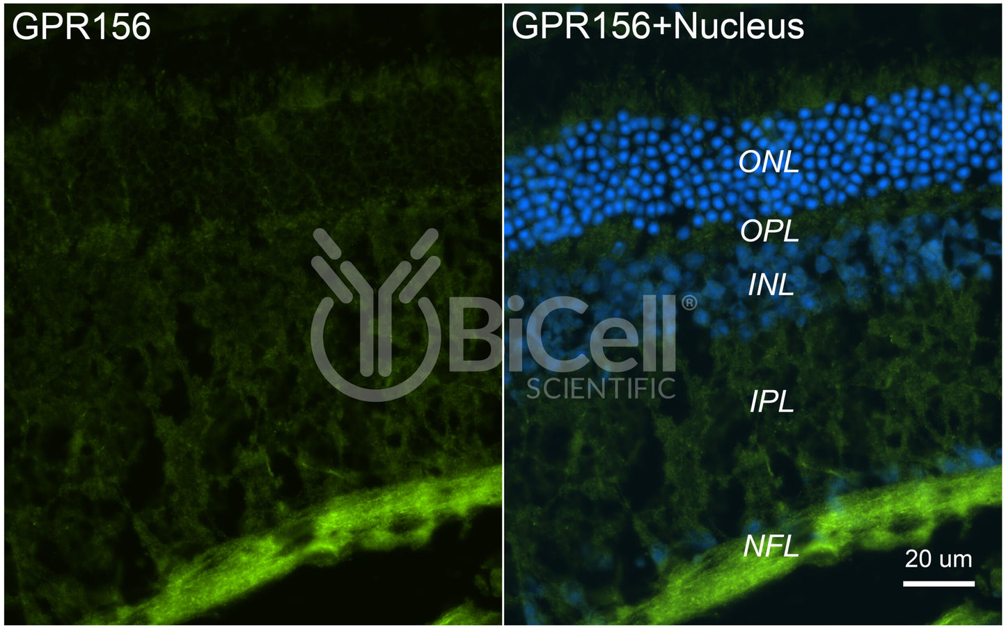 GPR156 (GABABL) Antibody - FFPE Validated