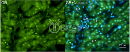 GR (NR3C1) Antibody - FFPE Validated