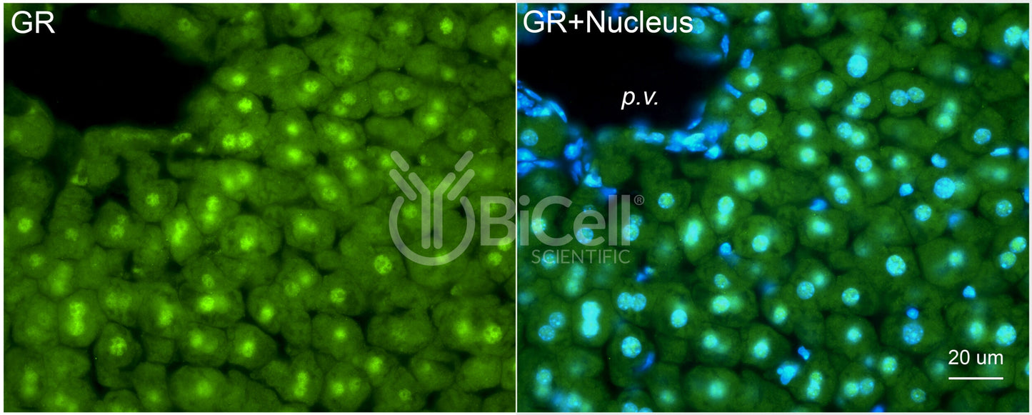 GR (NR3C1) Antibody
