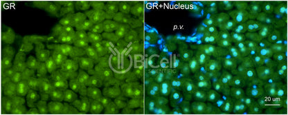 GR (NR3C1) Antibody - FFPE Validated