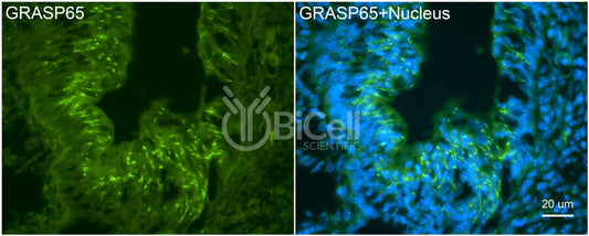 GRASP65 (GORASP1) Antibody - FFPE Validated