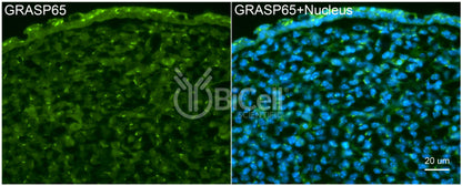 GRASP65 (GORASP1) Antibody - FFPE Validated