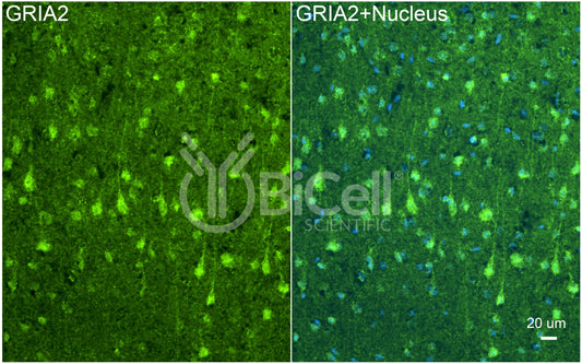 GRIA2 (GluR2 or GluA2) Antibody - FFPE Validated
