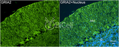 GRIA2 (GluR2 or GluA2) Antibody - FFPE Validated