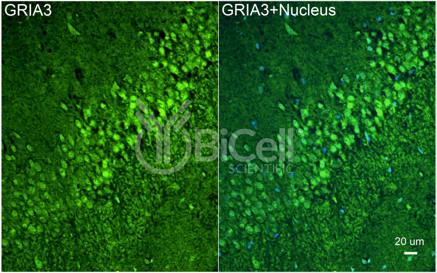 GRIA3 (GluR3 or GluA3) Antibody