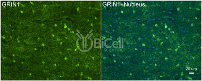 GRIN1 (GluN1) Antibody - FFPE Validated