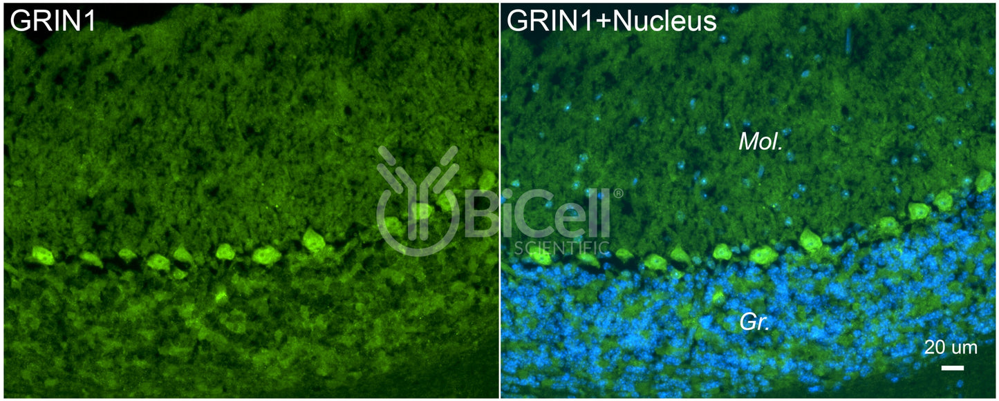 GRIN1 (GluN1) Antibody - FFPE Validated