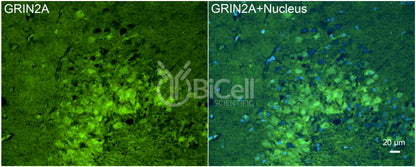 GRIN2A (GluN2A) Antibody - Western Blot Validated
