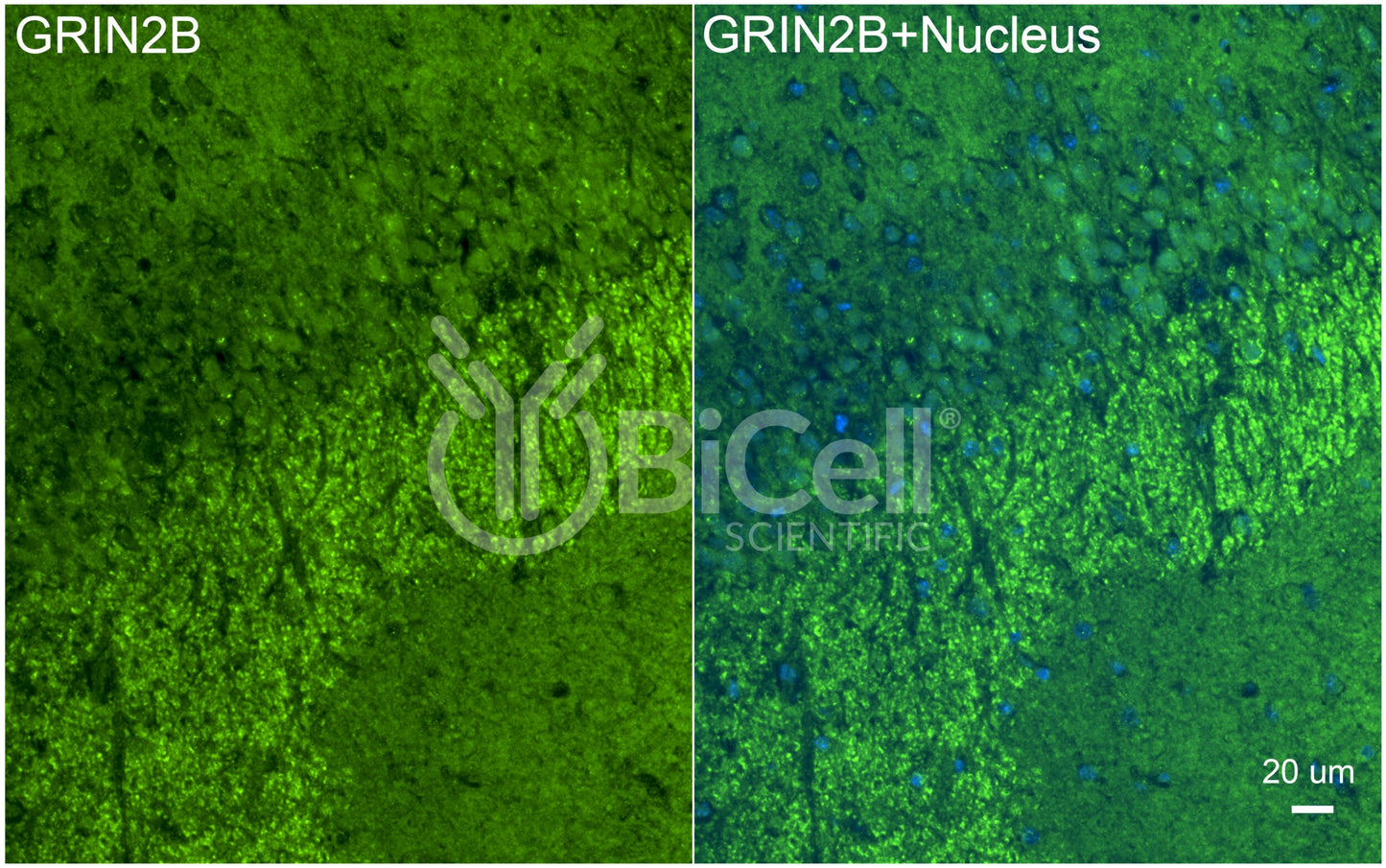 GRIN2B (GluN2B) Antibody - FFPE Validated