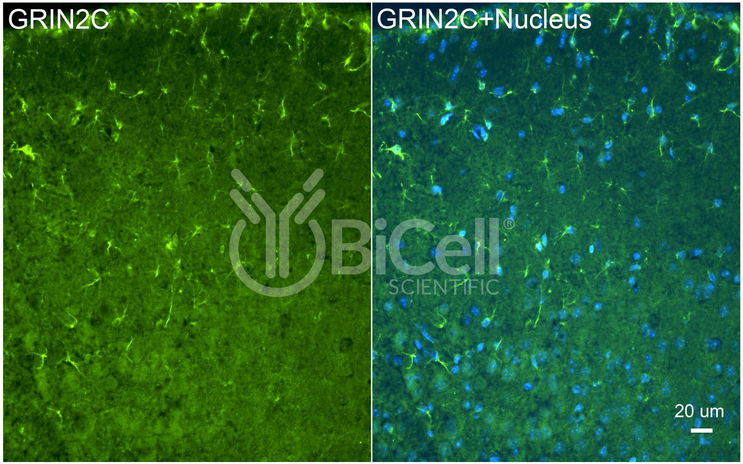 GRIN2C (GluN2C) Antibody - FFPE Validated