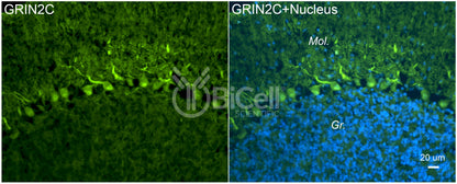 GRIN2C (GluN2C) Antibody - FFPE Validated