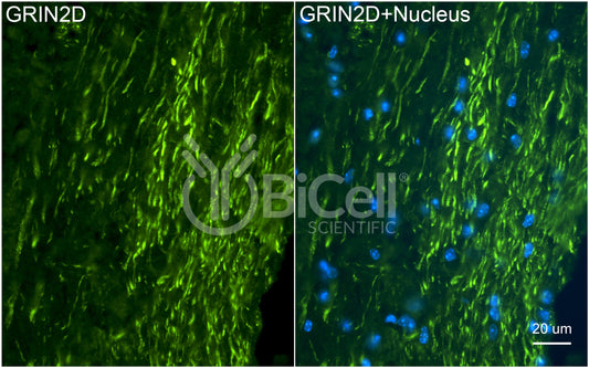 GRIN2D (GluN2D) Antibody