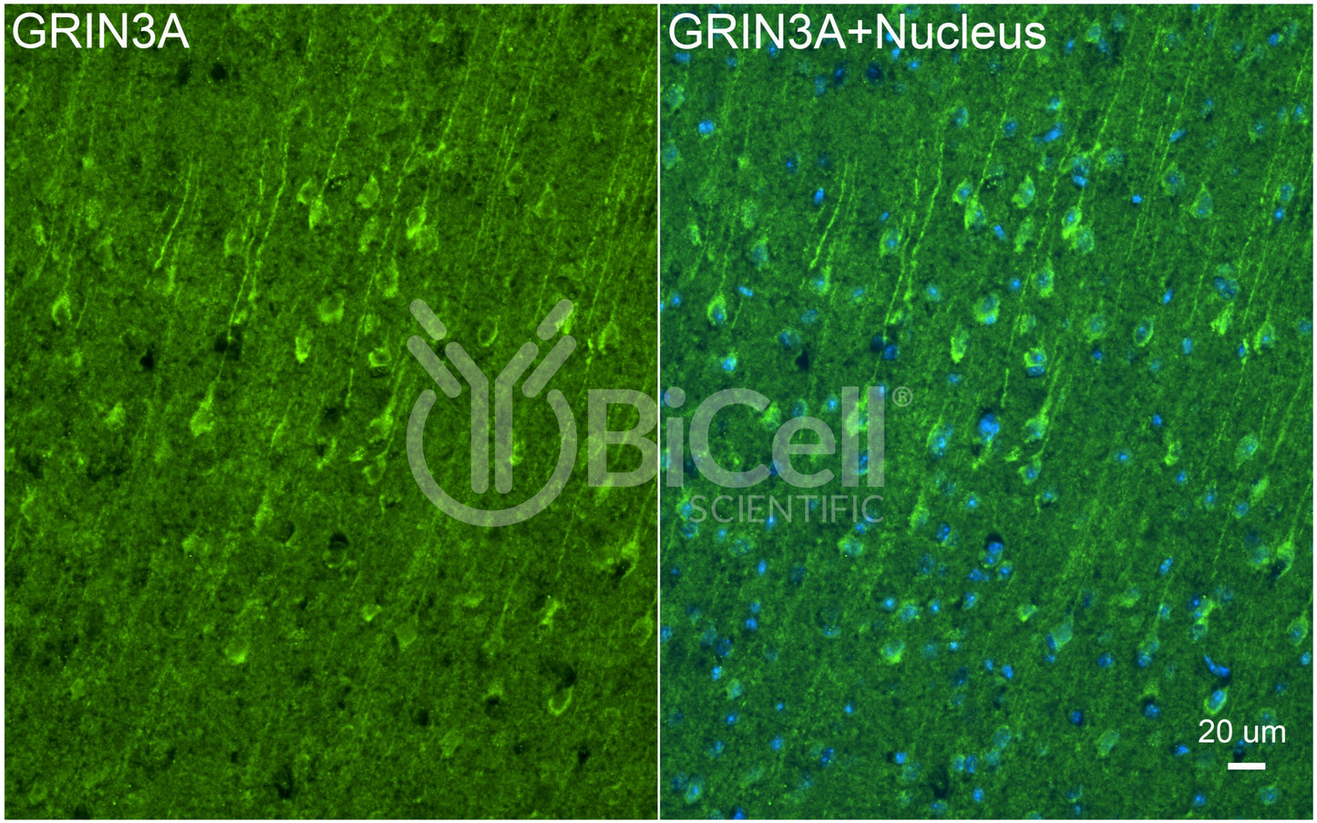 GRIN3A (GluN3A) Antibody - Western Blot Validated