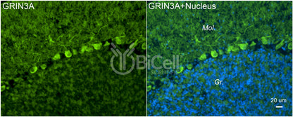GRIN3A (GluN3A) Antibody - FFPE Validated