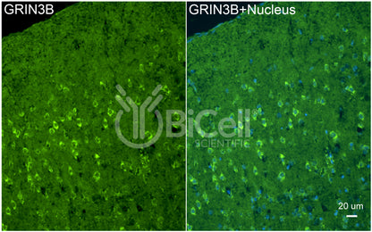 GRIN3B (GluN3B) Antibody - FFPE Validated