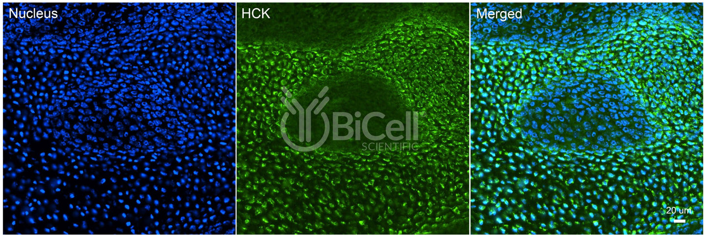 HCK Antibody - Western Blot Validated