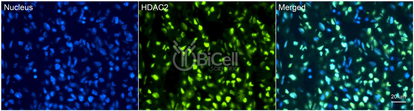 HDAC2 Antibody - FFPE Validated