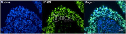 HDAC2 Antibody - Western Blot Validated