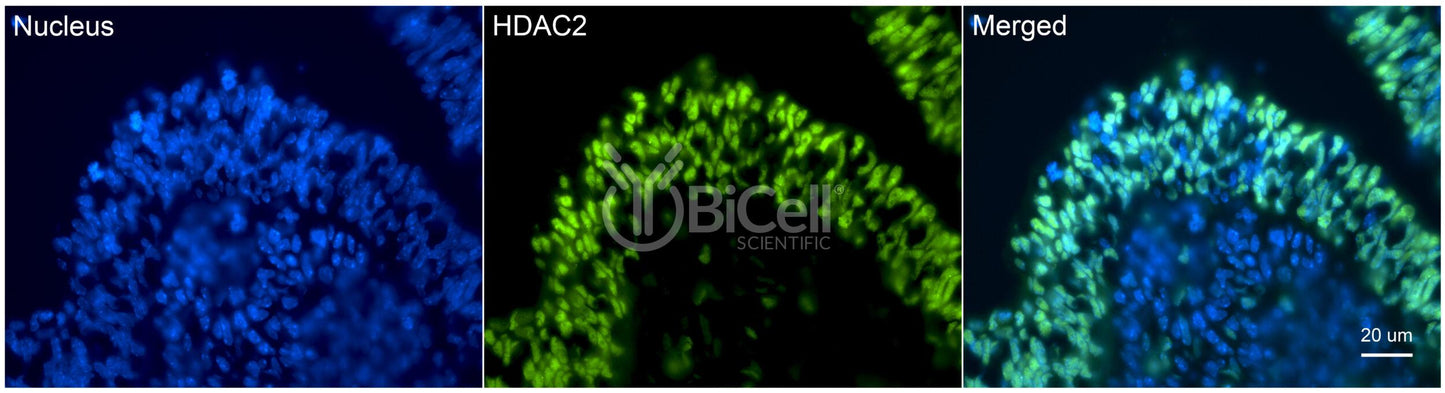 HDAC2 Antibody - FFPE Validated