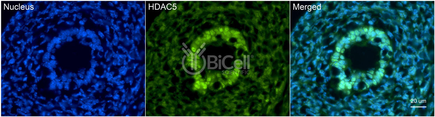 HDAC5 Antibody - Western Blot Validated