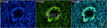 HDAC5 Antibody - FFPE Validated