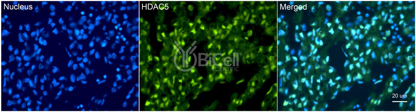 HDAC5 Antibody
