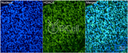 HDAC5 Antibody - FFPE Validated