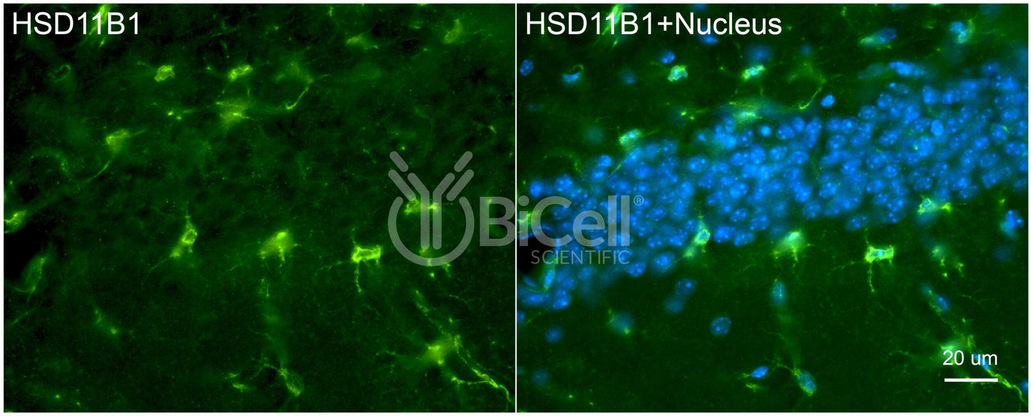 11-beta-HSD1 (HSD11B1) Antibody