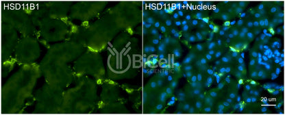 11-beta-HSD1 (HSD11B1) Antibody