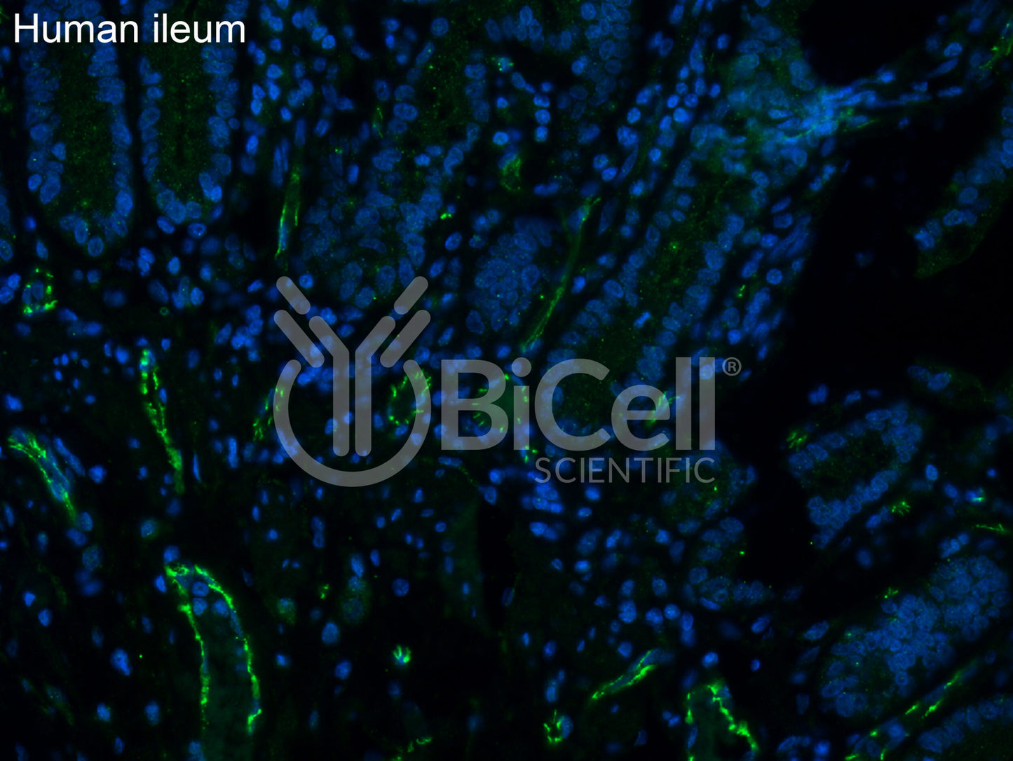 Claudin-5 (CLDN5) Antibody - Western Blot Validated