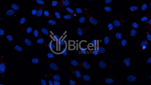 ARL13B (Human) (ARL2L1) HiRe (Rabbit) Antibody - FFPE Validated