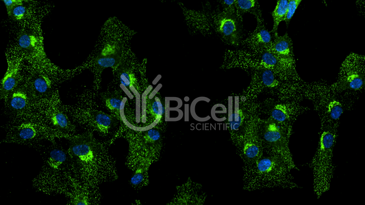 Clathrin Heavy Chain (CLTC) HiRe Antibody - Western Blot Validated