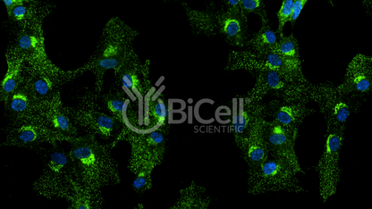 Clathrin Heavy Chain (CLTC) HiRe Antibody
