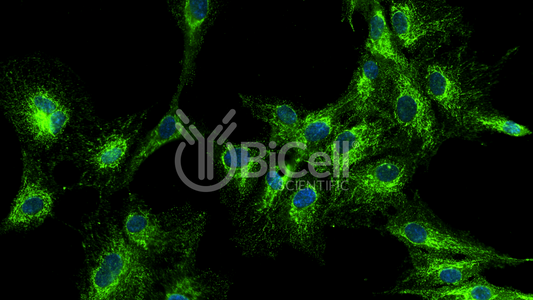 VAMP1 (SYB1) HiRe Antibody - Western Blot Validated