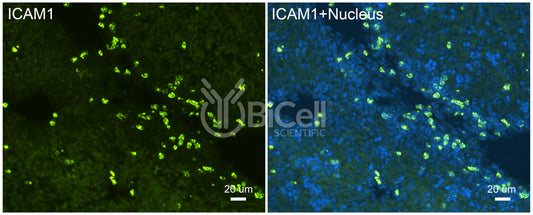 ICAM1 (CD54) Antibody