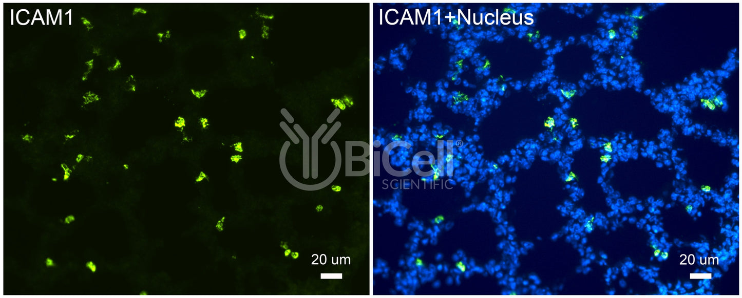 ICAM1 (CD54) Antibody - Western Blot Validated