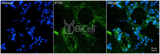 IFT52 Antibody - FFPE Validated