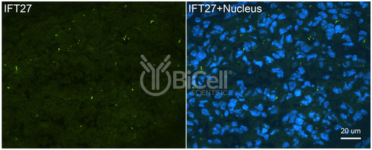 IFT27 (BBS19) Antibody